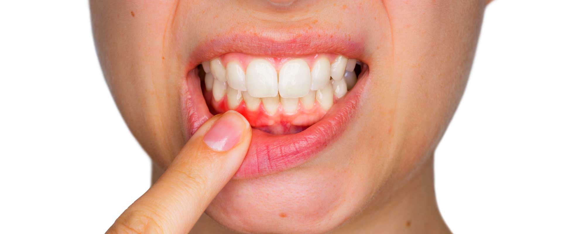 Oakridge Crossing Dental | SW Calgary Dentist | Periodontal Care in Calgary