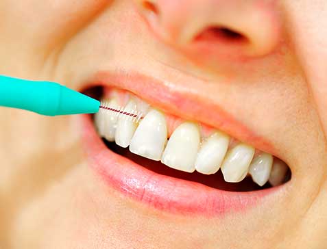 Oakridge Crossing Dental | SW Calgary Dentist | Periodontal Care Calgary, AB