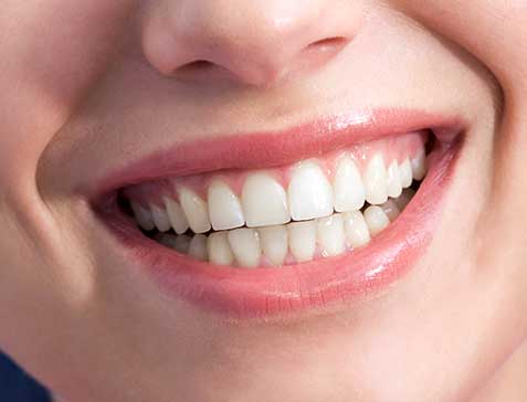 Oakridge Crossing Dental | SW Calgary Dentist | Teeth Whitening